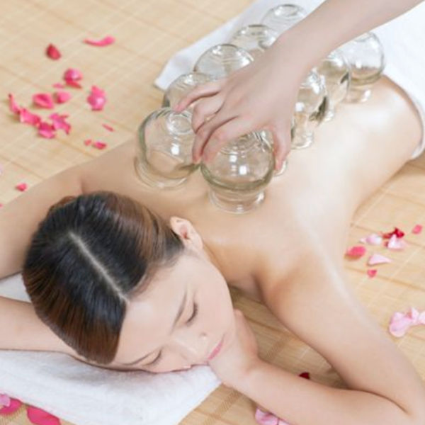 Cupping